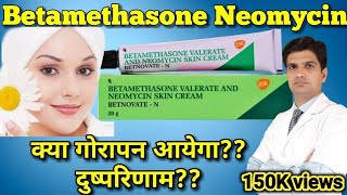 Betnovate N cream  Betamethasone Neomycin cream  betnovate n skin cream [upl. by Lainahtan]