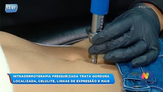 BG  Intradermoterapia pressurizada trata gordura localizada [upl. by Adnaral981]