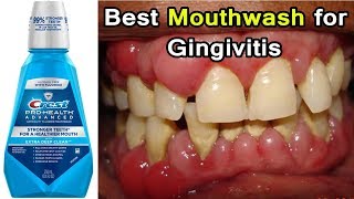 Top 3 Best Mouthwashes for Gingivitis Disease  Periodontal Disease [upl. by Kcuhc600]