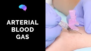 How to take an arterial blood gas ABG  OSCE guide  UKMLA  CPSA  PLAB 2 [upl. by Rhu]