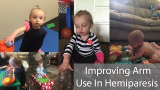 Improving Arm Use In Hemiparesis [upl. by Cnahc56]