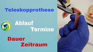 Die Teleskopprothese  Ablauf Termine Dauer und Zeitraum [upl. by Colis]