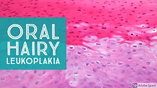 Oral Hairy LeukoplakiaExplained by a Dermatopathologist [upl. by Niwhsa]