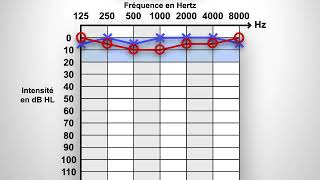 Audiogramme [upl. by Oicnerolf]