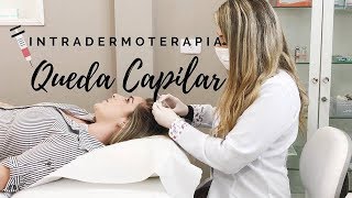 Meu tratamento capilar para queda de cabelo  Intradermoterapia Capilar [upl. by Merv]