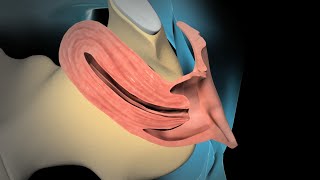 Dilation and Curettage D amp C [upl. by Adlesirg81]