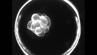 Blastocyst Development  Day 3 to Day 5 MUST SEE [upl. by Yhtrod]