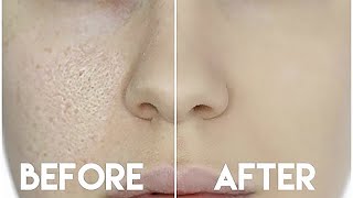 HOW TO HIDE ENLARGED PORES amp MAKE YOUR PORES DISAPPEAR [upl. by Guidotti]