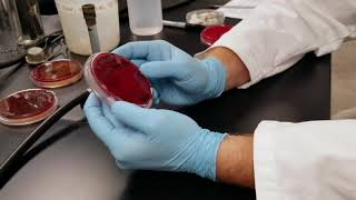 Blood Agar and Hemolysis [upl. by Revlys]