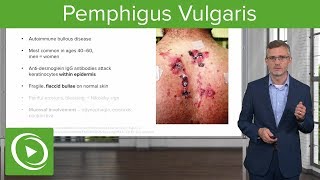 Pemphigus Vulgaris – Dermatology  Lecturio [upl. by Statis73]