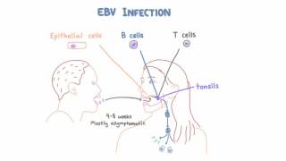 EBV and Mononucleosis  Pathogenesis and Clinical Presentation [upl. by Zile]