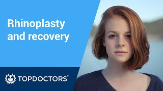 Rhinoplasty how long is recovery [upl. by Edelstein]