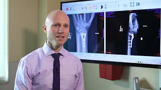 Boxers Fracture  Everything You Need To Know  Dr Nabil Ebraheim [upl. by Kelsy]