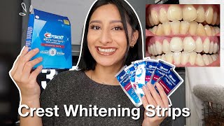 I TRIED THE CREST 3D WHITESTRIPS FOR 14 DAYS Effective  Before amp After pictures [upl. by Scharf783]