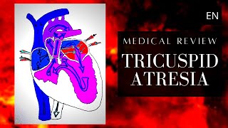 Tricuspid Atresia Anatomy Pathology and Treatment [upl. by Friday934]