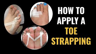 How Do I Do Toe Strapping Dislocated and Fractured Toe [upl. by Carmon]