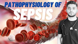 1 Gram Negative Sepsis [upl. by Shauna225]