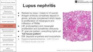 Glomerular diseases [upl. by Otte192]