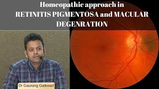 Homeopathic approach in RETINITIS PIGMENTOSA and MACULAR DEGENERATION Dr Gaurang Gaikwad [upl. by Arrim]