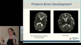 Neurodevelopment of Preterm Babies [upl. by Neddie]