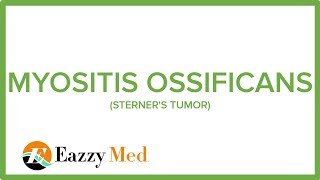 MYOSITIS OSSIFICANS STERNERS TUMOR [upl. by Hepza170]