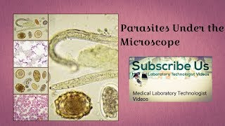 Parasites Under The Microscope [upl. by Gudrin]