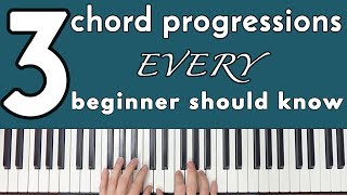 Common Chord Progressions Every Beginner Should Know [upl. by Ahsitniuq]