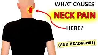 What Causes Upper Neck Pain And Headaches [upl. by Nosnor]