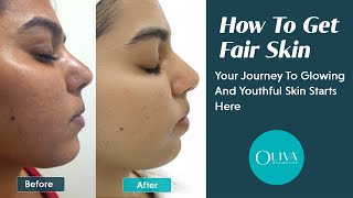 Fair Skin Secrets Revealed  Myths Facts And Treatment Options [upl. by Azile]