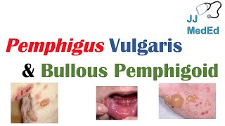 Vesiculobullous Skin Diseases  Pemphigus Vulgaris vs Bullous Pemphigoid [upl. by Angeli513]