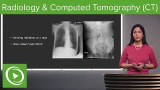 Radiology and Computed Tomography CT – Radiology  Lecturio [upl. by Wilser590]