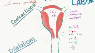 Preterm Labor visual summary [upl. by Hoye46]