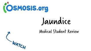 Jaundice  Clinical Presentation [upl. by Garratt358]