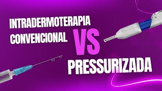 Intradermoterapia Convencional VS Pressurizada [upl. by Lud]