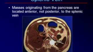 Sonography of the Pancreas and Spleen [upl. by Ahseka]