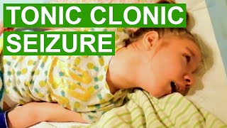 Tonic Clonic Seizure Video [upl. by Sicnarf]