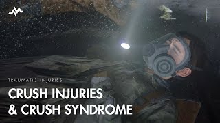 Crush Injury and Crush Syndrome  The Last of Us [upl. by Leverick890]