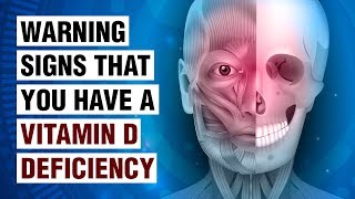 14 Signs Of Vitamin D Deficiency [upl. by Shepherd]