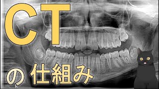 【10分で解説】図解：CTの仕組み [upl. by Shalne344]