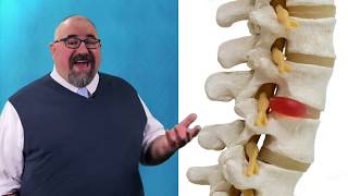 Understanding Degenerative Disc Disease and the Treatment Options  Dr Andrew Manista [upl. by Salahcin398]