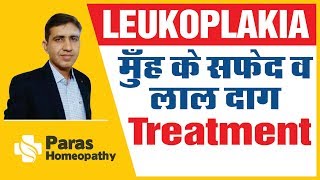 Leukoplakia  मुँह के सफ़ेद व लाल दाग  Leukoplakia Homeopathic Treatment [upl. by Yenohtna574]