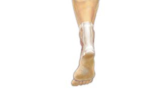 Achilles Tendon Repair Surgery PreOp® Patient Education [upl. by Oicapot]