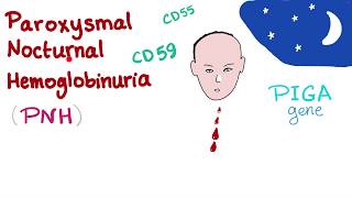 Paroxysmal Nocturnal Hemoglobinuria PNH  Hemolytic Anemia  Complement Alternative Pathway [upl. by Nytnerb110]