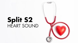 Fixed Split S2  Heart Sounds  MEDZCOOL [upl. by Oeniri]