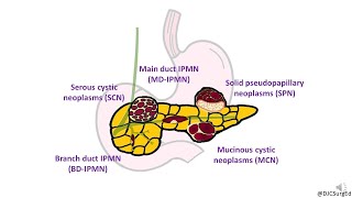 Neoplasia Nomenclature  Benign Tumors  Adenoma  Papilloma [upl. by Zeph]