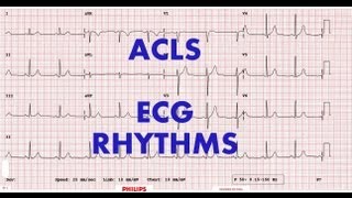 ACLS  ECG rhythm recognition amp management Part 1 [upl. by Benoite]