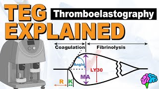 TEG Explained  Understanding the Thromboelastography [upl. by Annaid522]