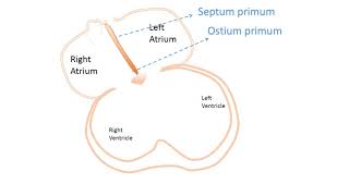 interatrial Septum development [upl. by Nnyleuqaj]