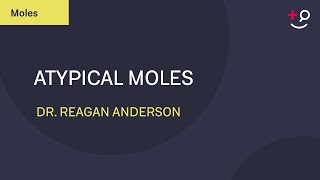 Atypical Moles What Are They Dermatology 2019 [upl. by Anuahs454]