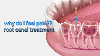 Ive got root canal treatment but why do I still feel pain [upl. by Gnov260]